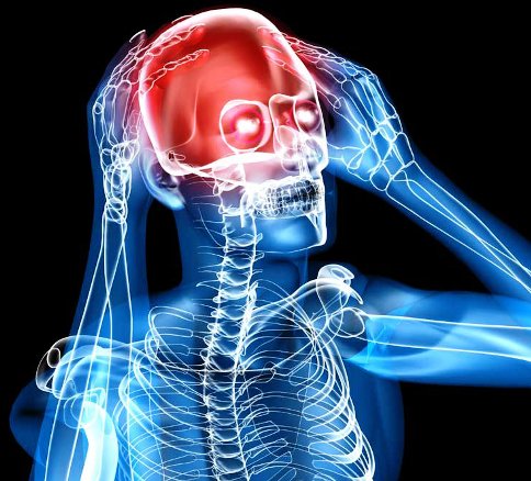 лечение сосудистой головной боли